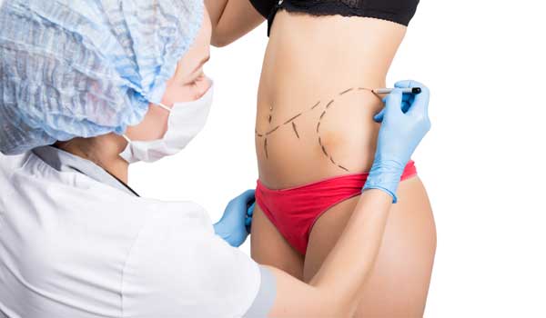 Plastic Surgery After Weight Loss - Types Of Surgical Procedures